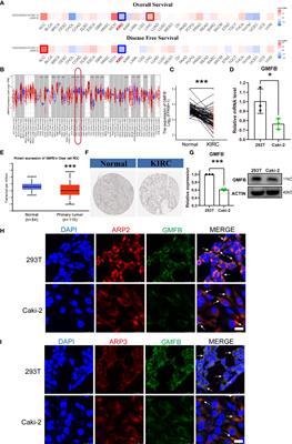 Glia Maturation Factor β as a Novel Independent Prognostic Biomarker and Potential Therapeutic Target of Kidney Renal Clear Cell Carcinoma